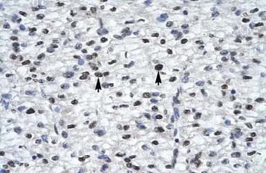 Gli2 antibody, Internal