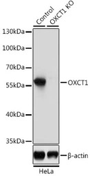 OXCT1 antibody