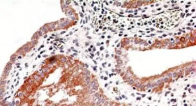 IKK beta antibody [10AG2]