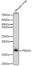Peroxiredoxin 5 antibody