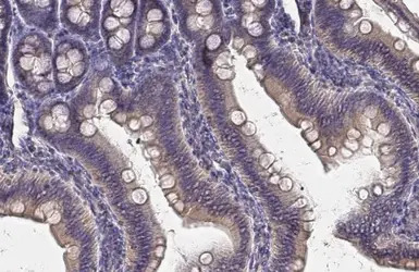 Von Hippel Lindau antibody