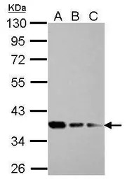 RPRD1B antibody