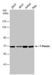T-Plastin antibody