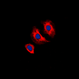 VEGF Receptor 2 (phospho Tyr11