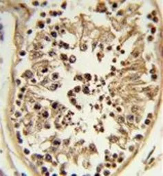 CHSY2 antibody, Internal