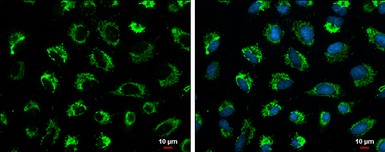 Glutaminase C (GAC) antibody [