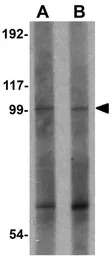 FRMPD2 antibody