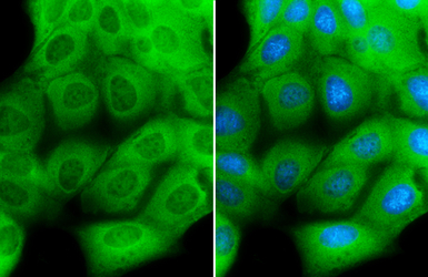 Creatine kinase (muscle) antib