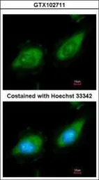 MAP3K8 antibody [N3C3]