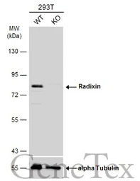 Radixin antibody