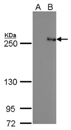 TET2 antibody [GT442]