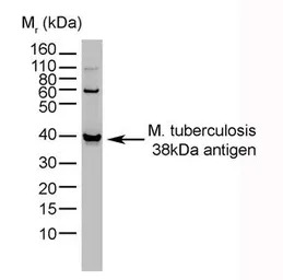 Mycobacterium tuberculosis 38 