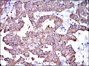 Cytokeratin 5 antibody [2C2B4]
