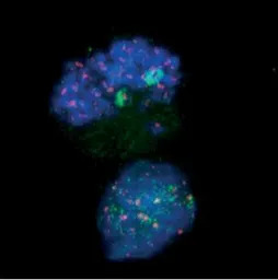 Histone H4K20me3 (trimethyl Ly