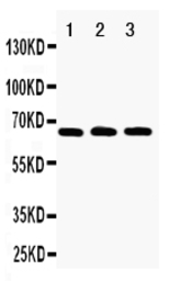 RANK antibody