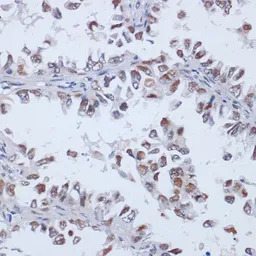 DNMT3L antibody