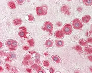 RPLP1 antibody [N1C3]