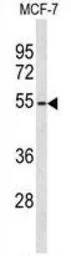 ADAMDEC1 antibody, N-term