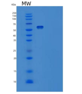 人肝配蛋白A受体2重组蛋白