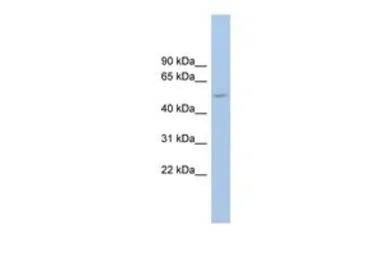 ANKRD13D antibody, Internal