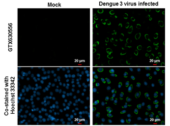 Dengue virus NS1 protein antib