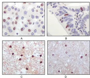 TIP60 antibody [3F9]