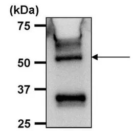 ATP5B antibody [4.3E8.D10]