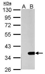 Galectin 4 antibody