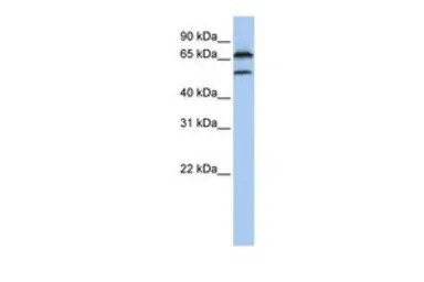 FBXO7 antibody, Internal