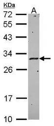 HLA-DmA antibody