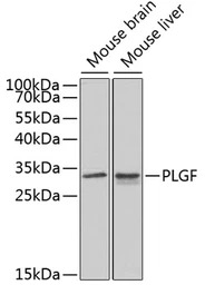 PLGF antibody