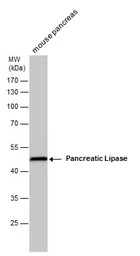 Pancreatic Lipase antibody [GT