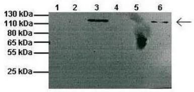 CLCN1 antibody, C-term