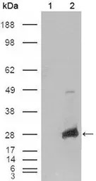 alpha B Crystallin antibody [1