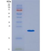 人干扰素α2(IFNa2)重组蛋白