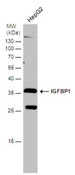 IGFBP1 antibody