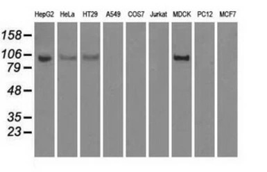 Hexokinase II antibody [4C5]