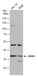 ARA9 antibody [N1C3]