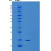 人线粒体裂变1蛋白/FIS1重组蛋白C-6His