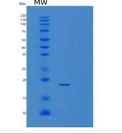 人肿瘤坏死因子α/肿瘤坏死因子α重组蛋白C-6His