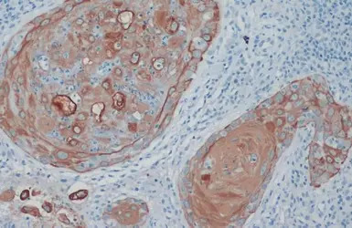 Cytokeratin 33B antibody