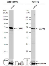 ZAP70 antibody