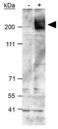 ABCA1 antibody