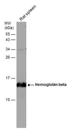 Hemoglobin beta antibody