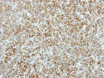 eEF2K antibody [N1N3]