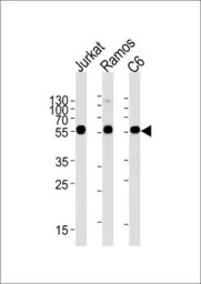 Calreticulin antibody, Interna