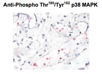 p38 MAPK (phospho Thr180/Tyr18