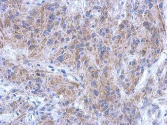 KATNAL1 antibody [C1C3]