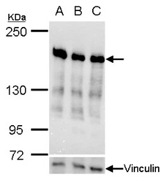 Ribosome binding protein 1 ant