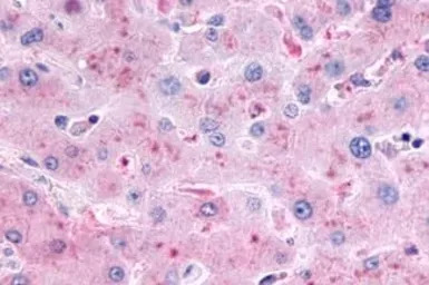 Glucagon receptor antibody